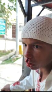 पतंग उड़ाने के विवाद में 10 वर्षीय छात्र को 02 महिलाओं ने पीट-पीट कर किया लहूलुहान