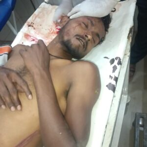 दो पक्षो मे मारपीट एक युवक की हालत नाजुक, चार के खिलाफ मुकदमा दर्ज